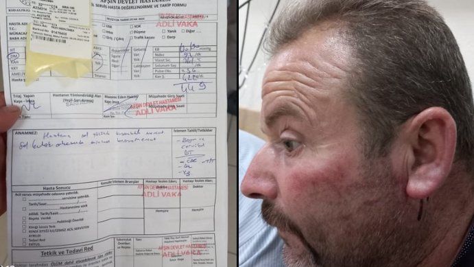 ‘Dövüldüm’ dedi Belediye önünde kendini yaktı