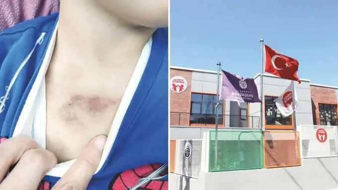 İBB kreşindeki çocuğa şiddet ve istismarda ayrıntılar ortaya çıktı: Çıplakken kameraya çekti!