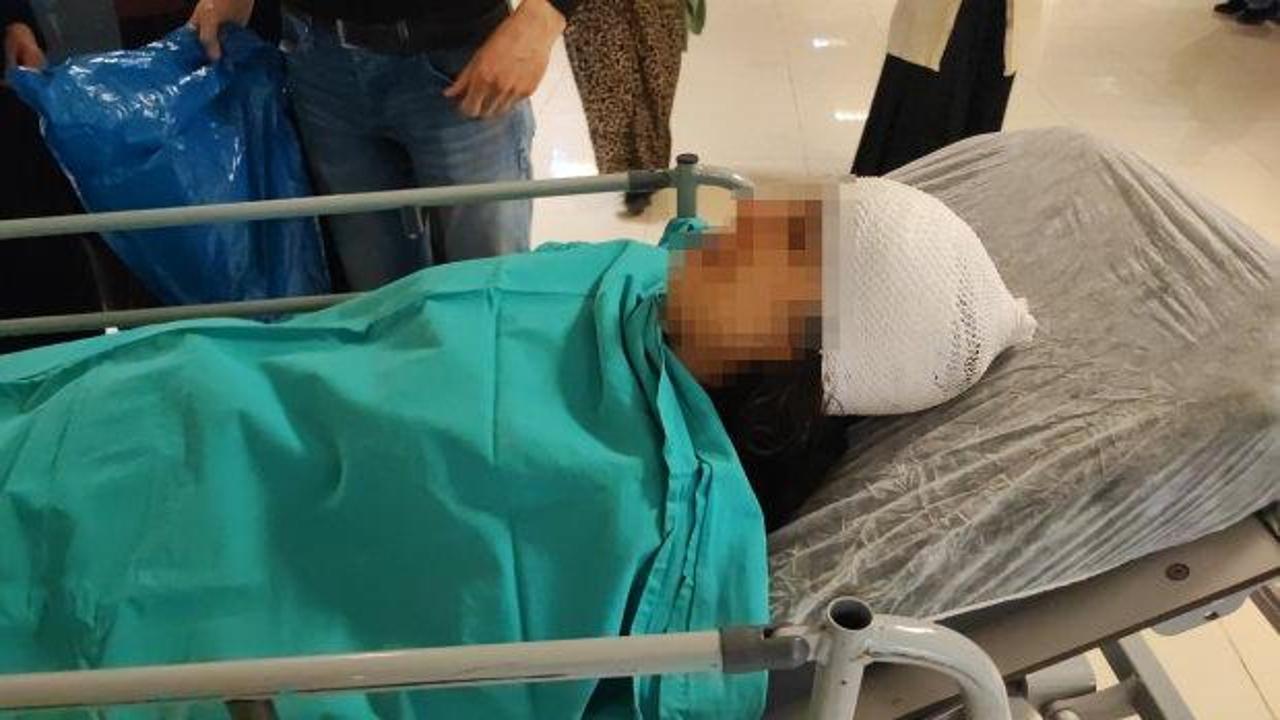 Başıboş köpekler genç kızın kafasını parçaladı!